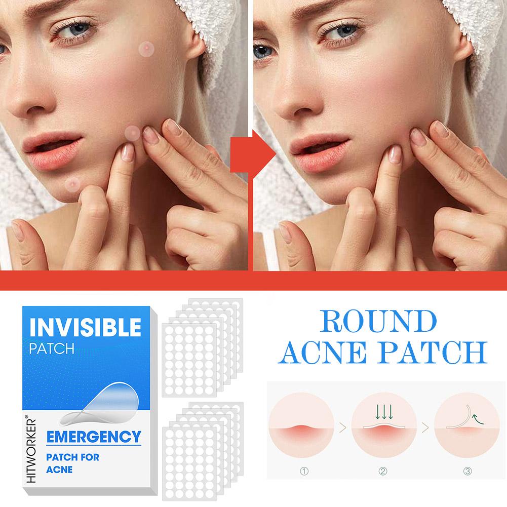 400/800/1200pcs Patch per l'ac - Beauty Makeup Quotes recensione e prezzo